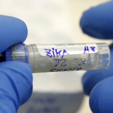 No hay nexo de zika y microcefalia: OPS