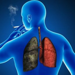 Evita cáncer de pulmón con detección oportuna