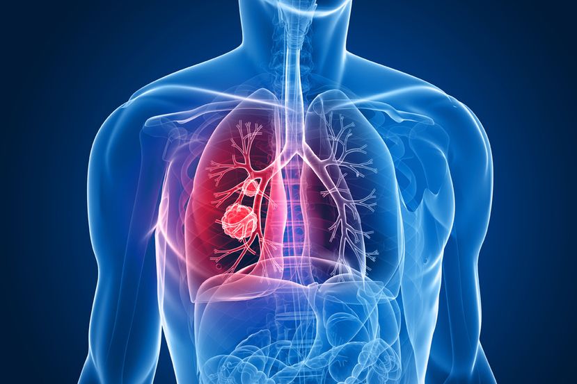 ¿Tú cuidas tus pulmones?