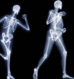 IOF lanza su campaña de concientización contra la Osteoporosis