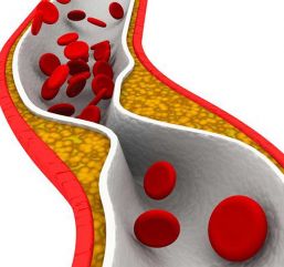 Sanofi presenta el primer anticuerpo monoclonal contra colesterol