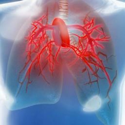 Detecta a tiempo la hipertensión pulmonar