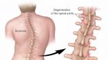 Verifica la columna vertebral de tu hijo